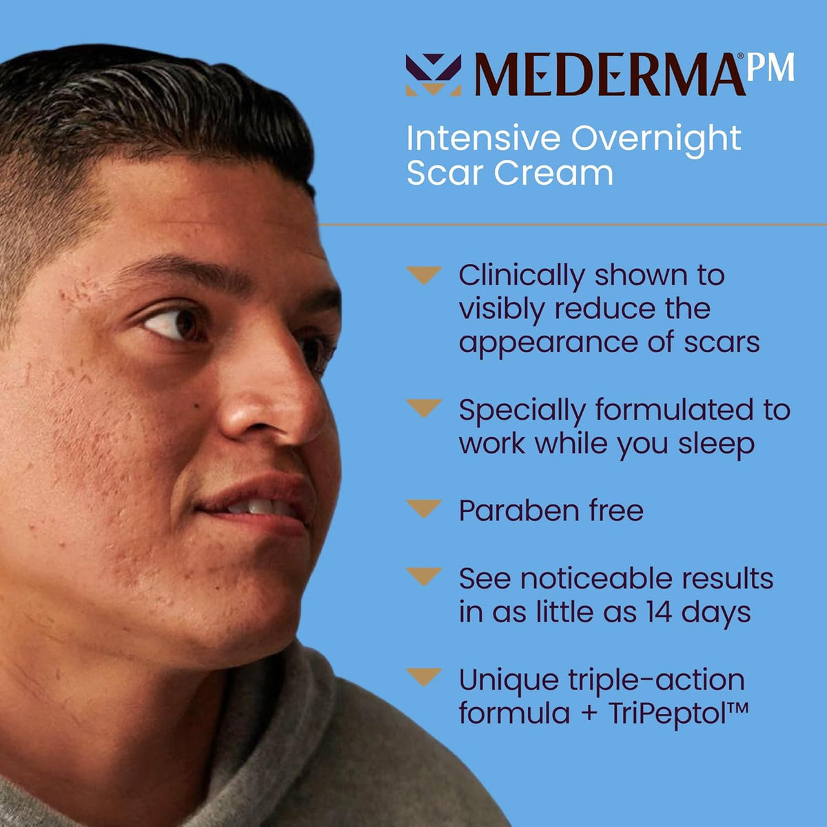1.7 Oz Scar Cream X3969